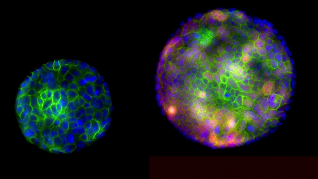 The image shows organoids (miniature, simplified versions of an organ) used to study gastric SCJ cancer. A mutant organoid with inactive tumor suppressor genes, right, grows faster than the normal organoid.
