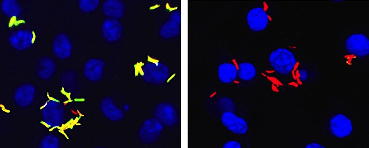 M. tuberculosis within macrophages were engineered to turn yellow-green when they eat cholesterol, left, and remain red when infected cells are treated with a compound that blocks bacterial cholesterol metabolism, thereby starving the pathogen, right. 