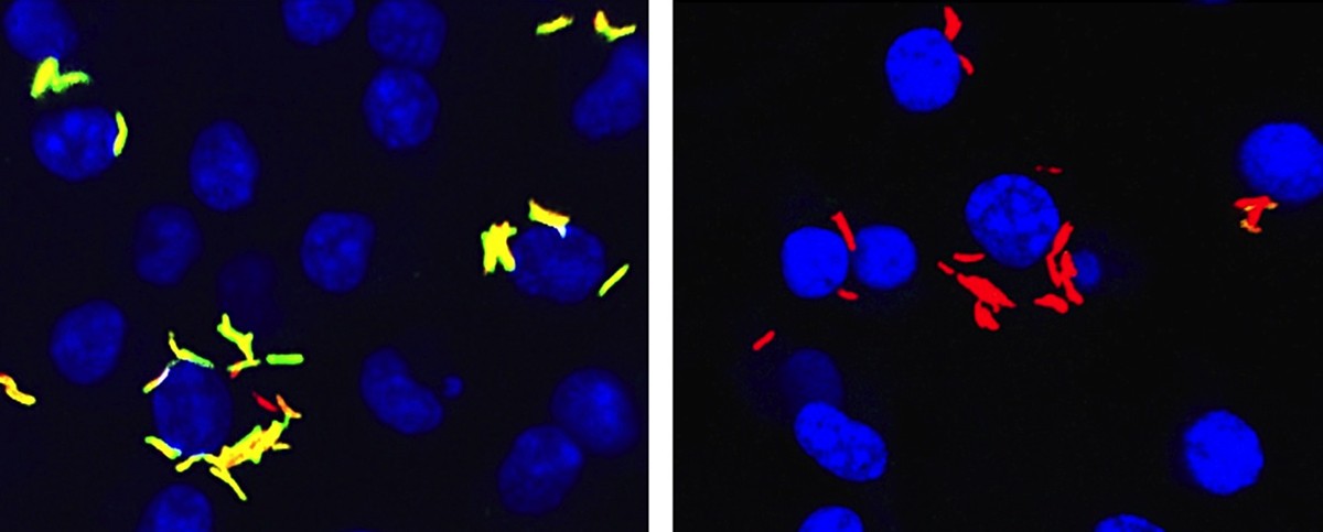 M. tuberculosis within macrophages were engineered to turn yellow-green when they eat cholesterol, left, and remain red when infected cells are treated with a compound that blocks bacterial cholesterol metabolism, thereby starving the pathogen, right.