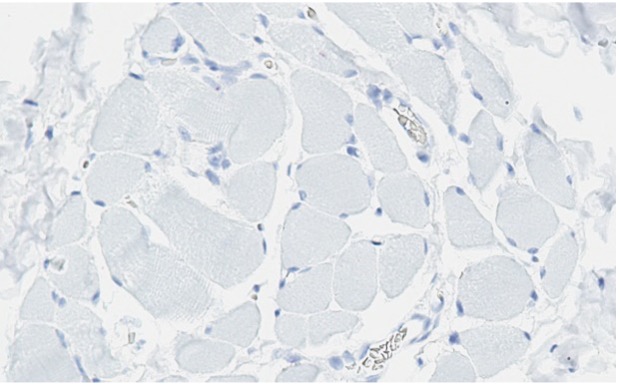 Negative tissue control