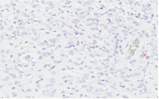 Canine oral melanoma