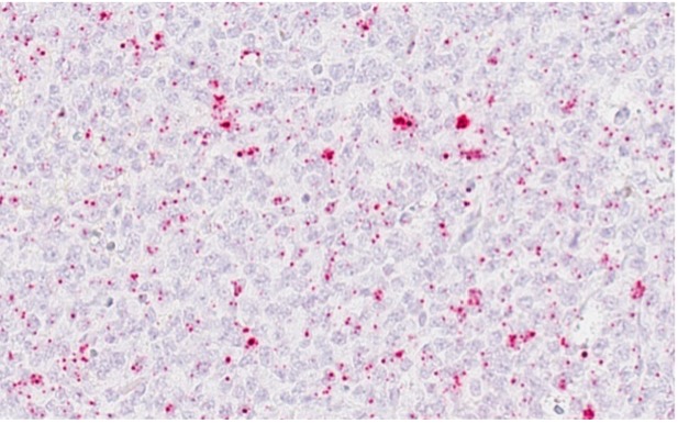 Canine diffuse large cell B-cell lymphoma