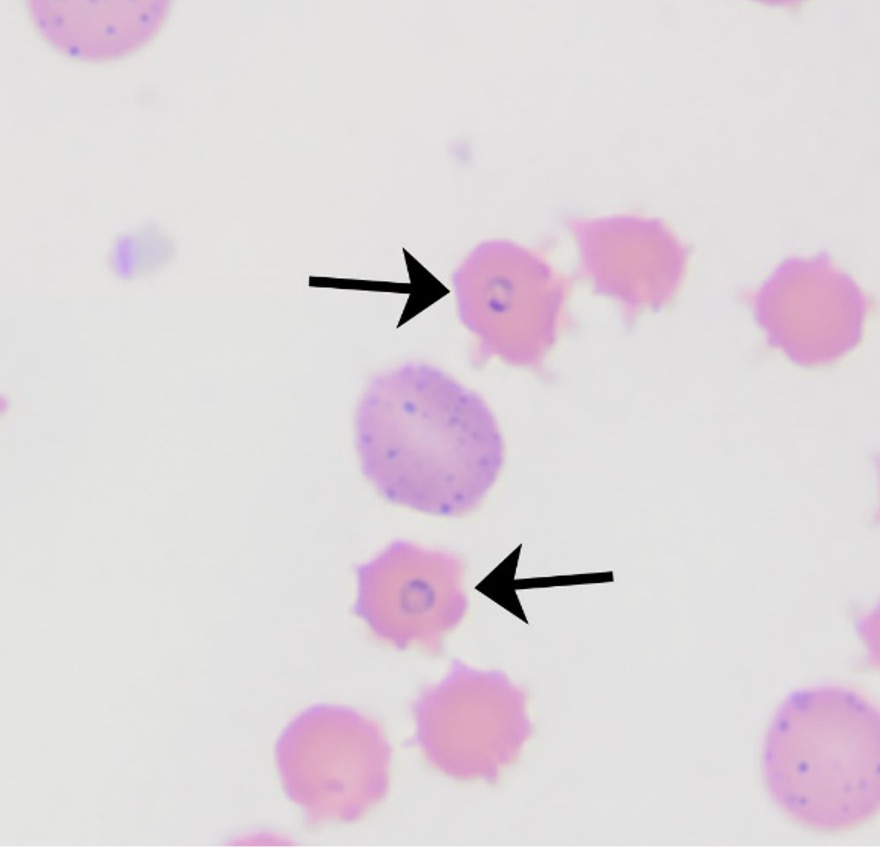 Piroplasms in red blood cells indicating oriental theileriosis