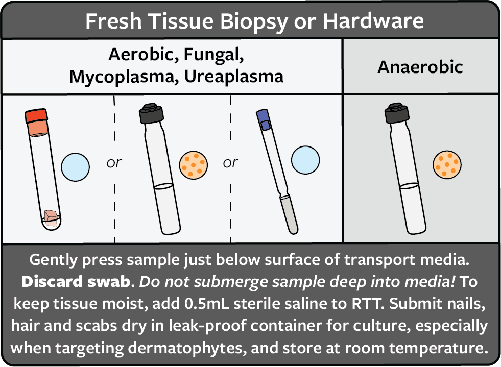 A chart explaining how to collect a specimen of fresh tissue