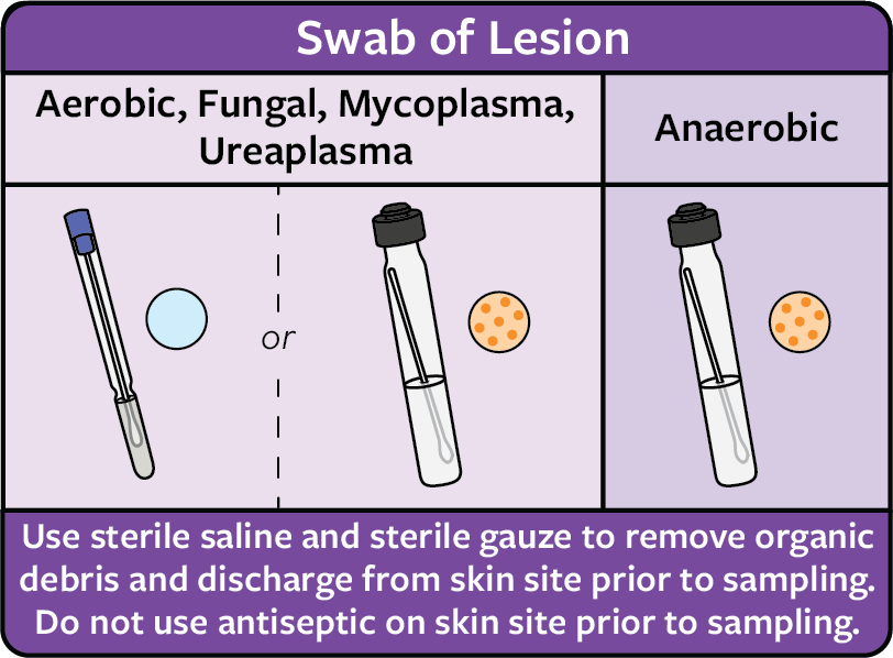 A chart explaining how to collect a specimen using a swab on a lesion