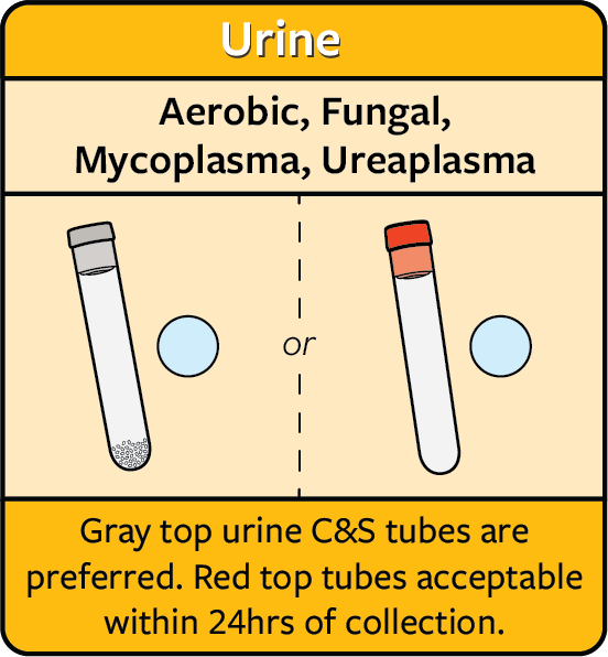 A chart explaining how to collect a specimen of urine