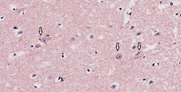Histology slide from rabies case