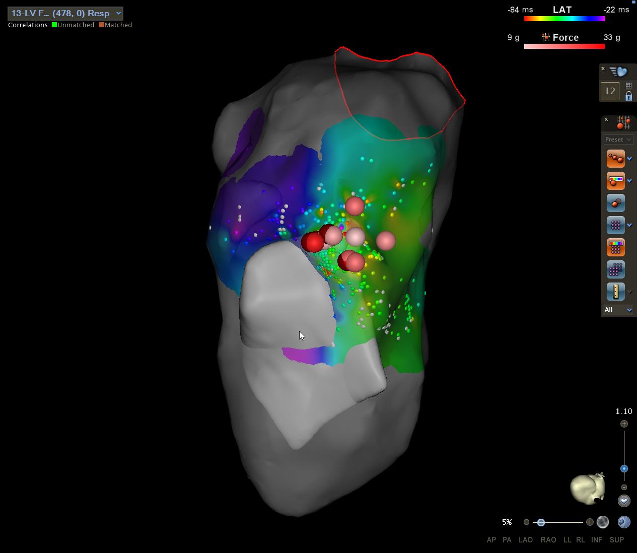 All ablation points on an electroanatomical map of a great Dane's heart