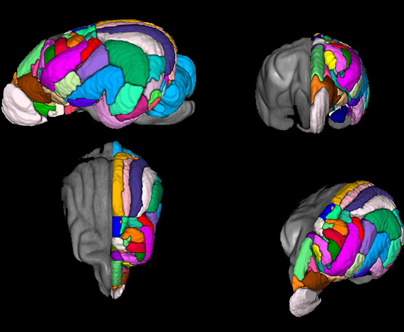 colorful mapping of the brain