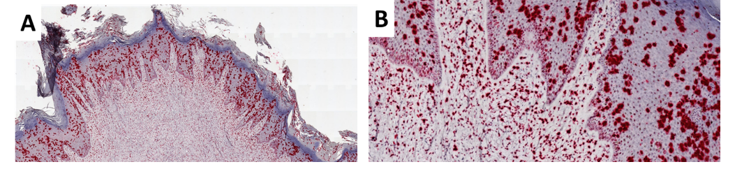 Bovine Fibropapilloma