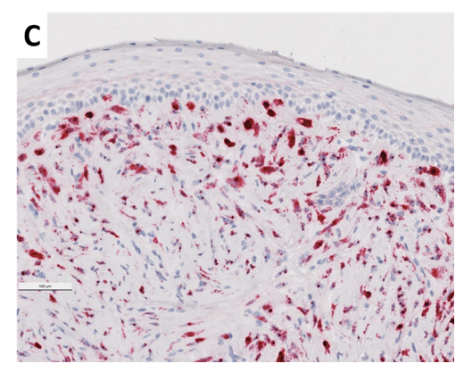 Bovine Fibropapilloma