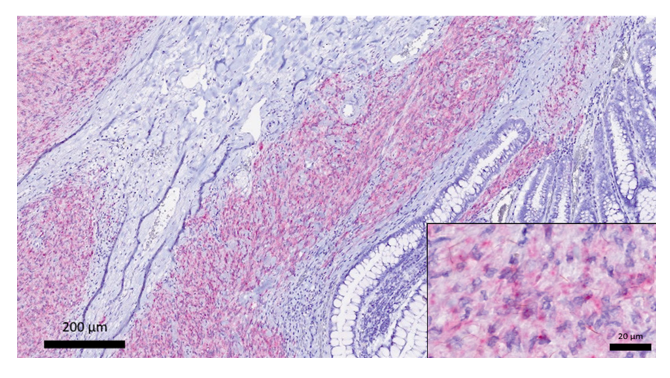 Canine Cecal Gastrointestinal Stromal Tumors