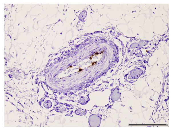 Canine Vesivirus