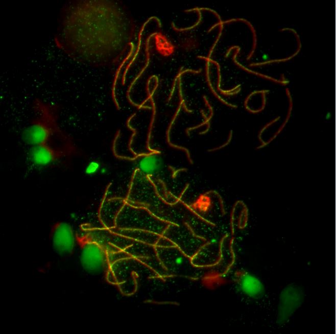 microscope image with red and green proteins