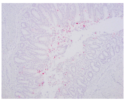 Escherichia coli nucleic acid sequence by in-situ hybridization