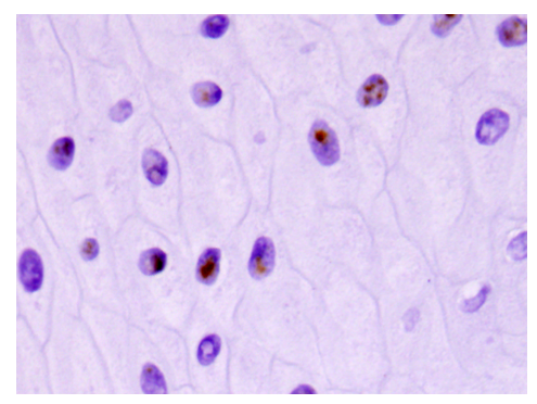 Equine Gastric Ulce rSyndrome