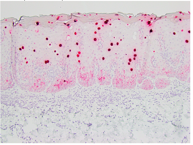 Equus caballus papillomavirus 2 (EcPV2) nucleic acid sequence by in-situ hybridization