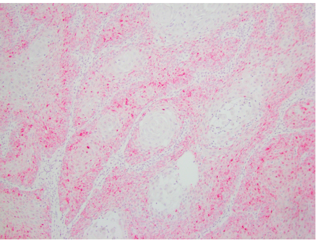 Equus caballus papillomavirus 2 (EcPV2) nucleic acid sequence by in-situ hybridization