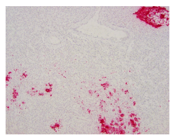 eubacterial nucleic acid sequence by in-situ hybridization