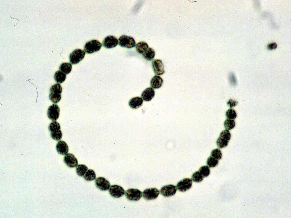 Anabaena/Cylindrosermum flos-aquae
