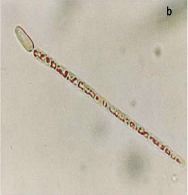 Cylindrospermopsis raciborskii