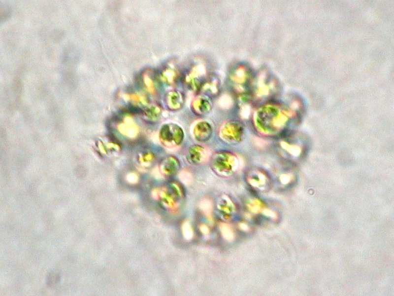 Microcystis aeruginosa