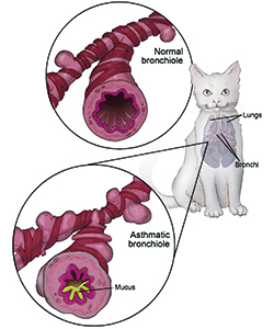 Asthmatic bronchiole