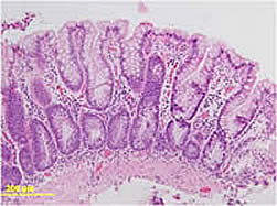 cell formation