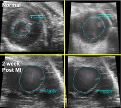 Echocardiography slides 