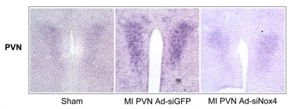 RNA slides showing Myocardial infarction increases transcription of Nox4 in the paraventricular nucleus, which can be inhibited by targeted delivery of small-interfering RNA.
