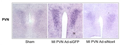 RNA slides showing Myocardial infarction increases transcription of Nox4 in the paraventricular nucleus, which can be inhibited by targeted delivery of small-interfering RNA.