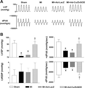 Graphs demonstrating Increased scavenging of superoxide in the forebrain improves myocardial function following MI.