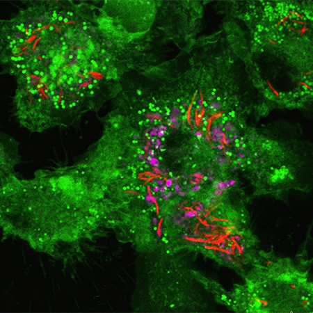 Bacterial Pathogenesis