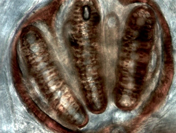 Spiracle of calliphorid larva
