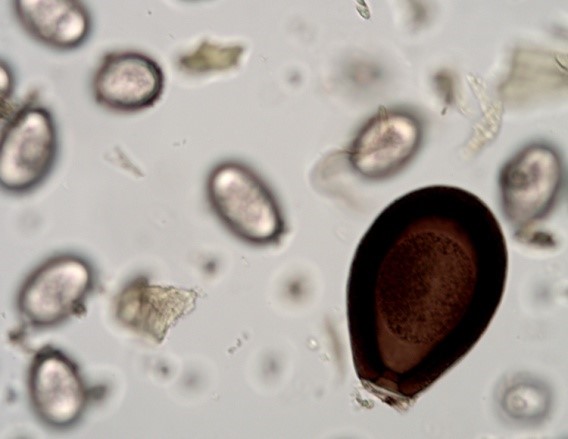 Eimeria macusaniensis oocyst