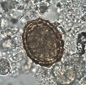 Ascaris suum egg