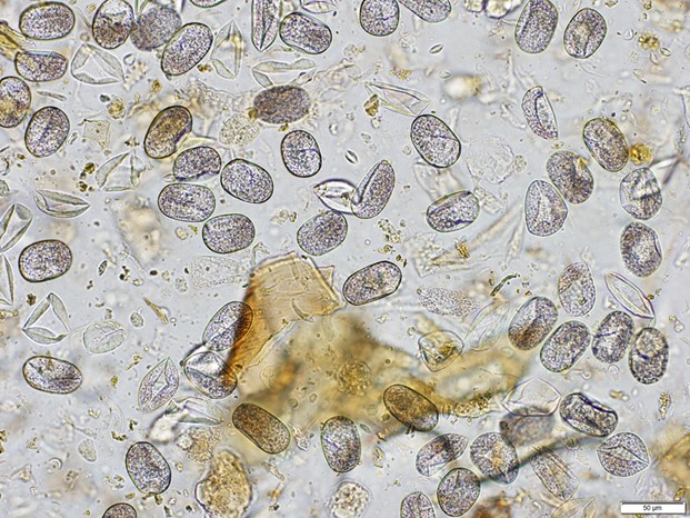 Strongyloides papillosus larvated eggs