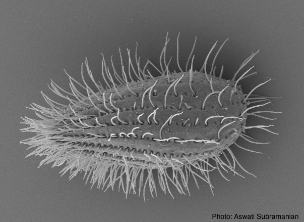 A tetrahymena cell imaged by a scanning electron micrograph