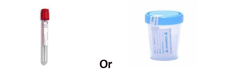 Any Sterile Container (no additives)