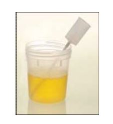 Urine Culture CUp