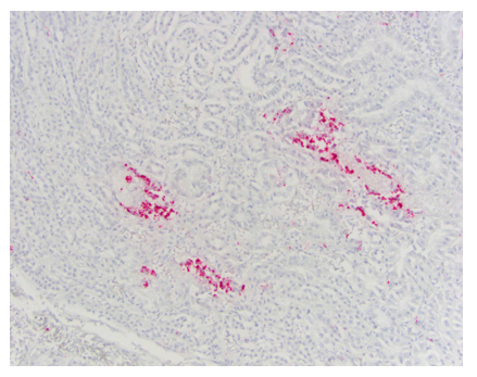 West Nile virus (WNV) nucleic acid sequence by in-situ hybridization