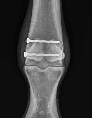 An after x-ray of a horse's joint when screws have been inserted
