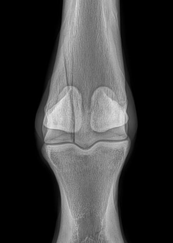 A before x-ray image of a horse's joint before screws are inserted