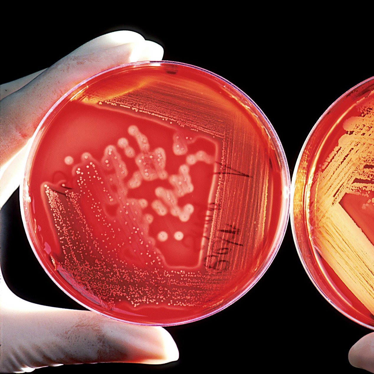 two agar plates