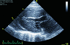 Echocardiogram image