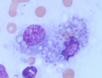 stained smear of a skin lesion from a cat with Histoplasmosis