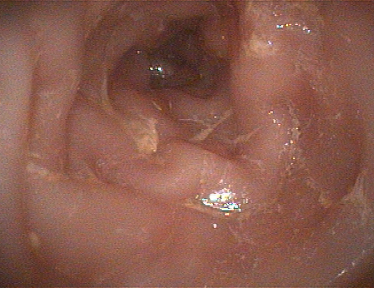 Inflammatory Bowel Disease Cornell University College Of Veterinary Medicine