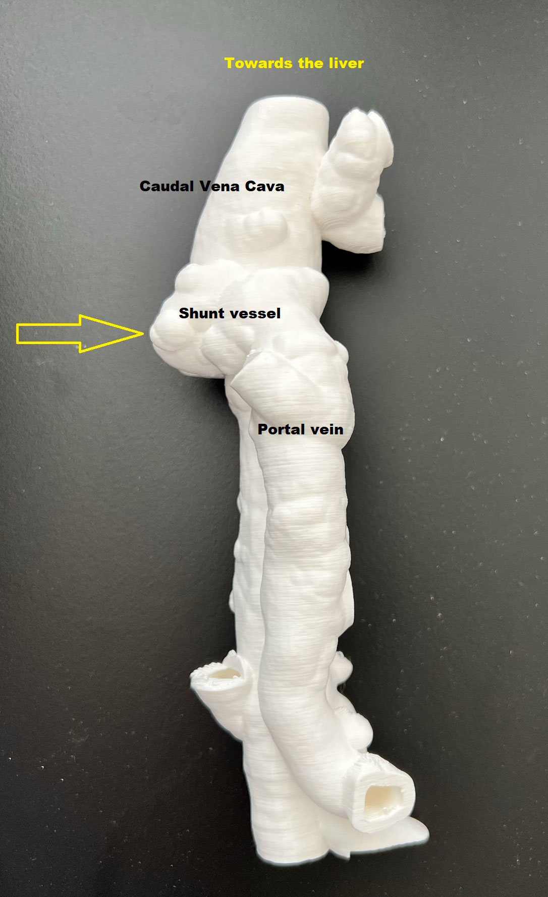 A 3D image of a canine liver shunt