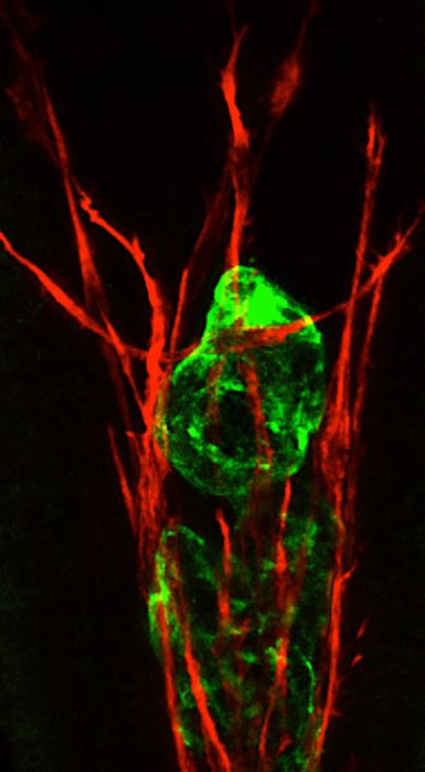 Intestinal lacteal