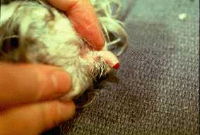 Toe nail and cuticle bleeding